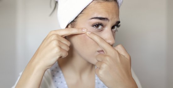 Acne: cause nascoste e soluzioni per riequilibrare la pelle dall'interno